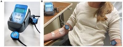 Detection of Excess Presence of 99mTc-MDP Near Injection Site—A Case Report